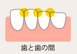歯と歯の間